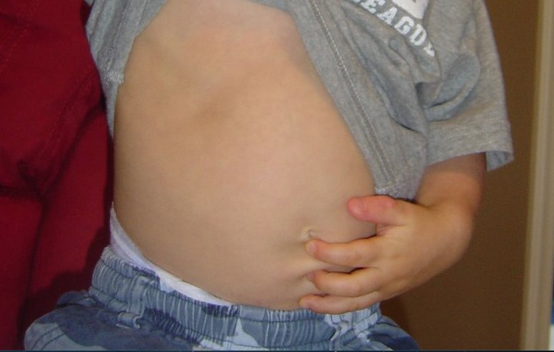 Belly Buttons1.png