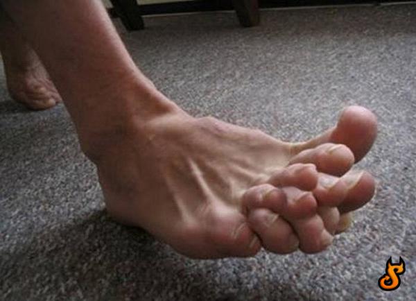 many-toes.jpg