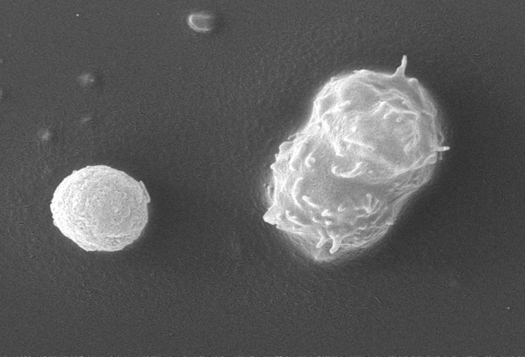 Acanthamoeba polyphaga protozoa